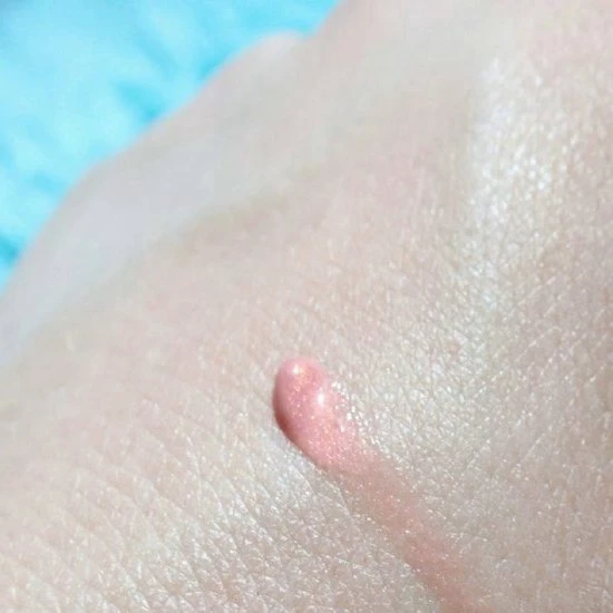 Korting ? Lippenbalsem Natural Pink Biodermal Sun Lipbalm Lipbalsem SPF25 - Tube 12 Ml - ✔️ 4 Korting ? Lippenbalsem Natural Pink Biodermal Sun Lipbalm Lipbalsem SPF25 - Tube 12 Ml - ✔️ - Afbeelding 4