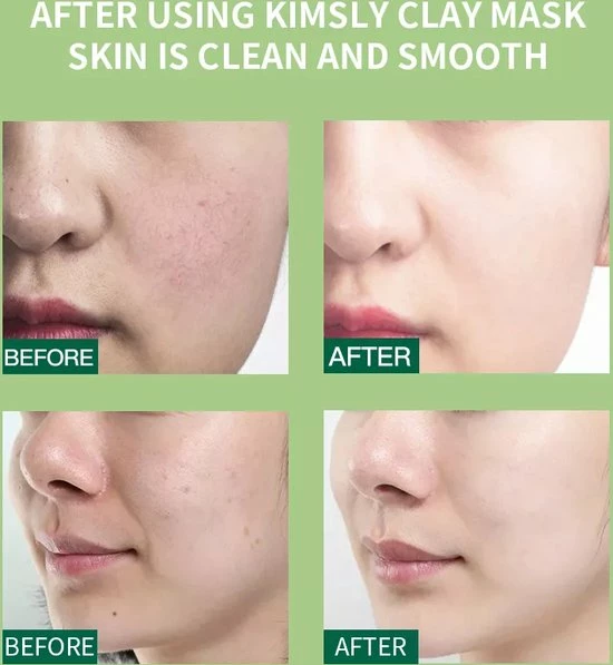 Groothandel ? AE Beauty - Kleimasker - Vegan - Modder Masker - Set Van 10 Stuks - Multi-Masking Mini Kit - Inbegrepen Applicator -Dode Zee - Avocado - Groene Thee - Aubergine - Rozen - Alle Huidtypen - Acne - Anti-aging - Blackheads ? 16 Groothandel ? AE Beauty - Kleimasker - Vegan - Modder Masker - Set Van 10 Stuks - Multi-Masking Mini Kit - Inbegrepen Applicator -Dode Zee - Avocado - Groene Thee - Aubergine - Rozen - Alle Huidtypen - Acne - Anti-aging - Blackheads ? - Afbeelding 16